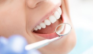 Tooth Extractions, Lethbridge Periodontist